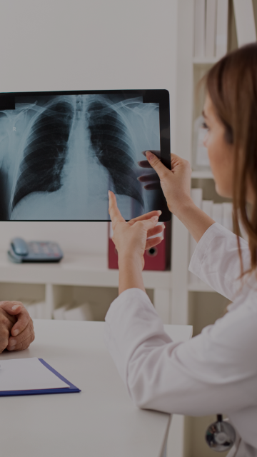 Cáncer de pulmón: ¿a qué médico asistir?