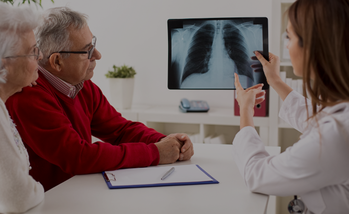 Cáncer de pulmón: ¿a qué médico debo asistir?