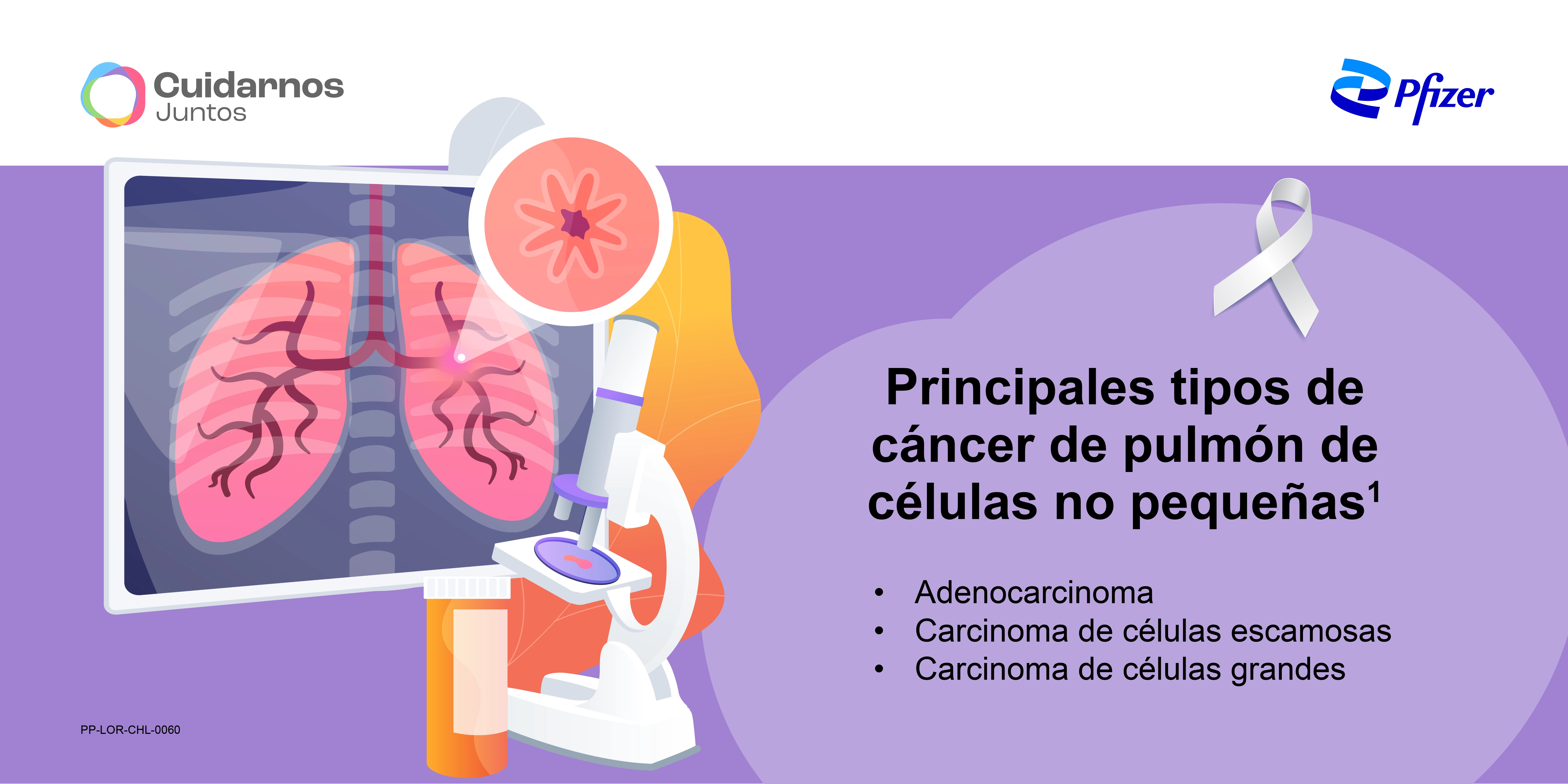 Principales tipos de cáncer de pulmón de células no pequeñas 