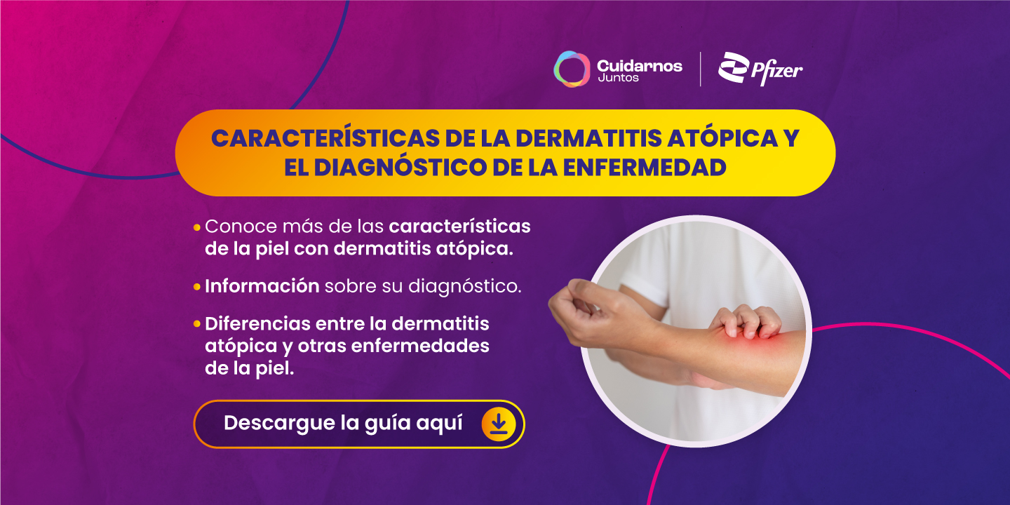 Guía de características y diagnóstico de la Dermatitis Atópica (DA)