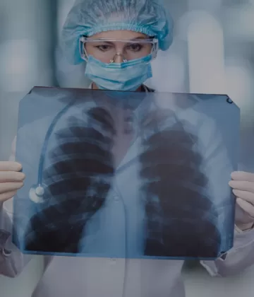 ¿Es cáncer u otra enfermedad respiratoria?