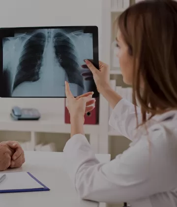 Cáncer de pulmón: ¿a qué médico debo asistir?